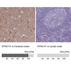 DNCIC1 Antibody, Novus Biologicals 25 &mu;L, Unlabeled:Antibodies, Polyclonal